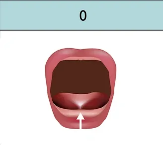 Tongue behind gum