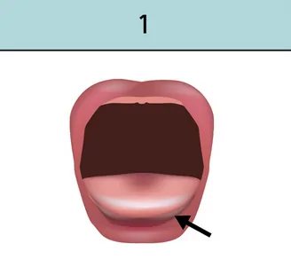 Tongue past gum