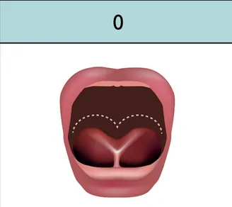 Tongue looks like a heart